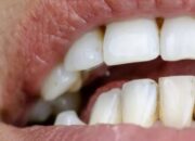 Sikat Gigi Rutin, Lindungi Otak, Cegah Demensia Dini