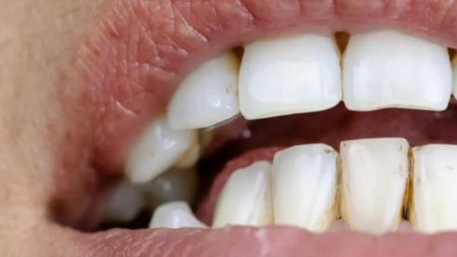 sikat-gigi-3-kali-sehari-cegah-demensia-dan-radang-sendi